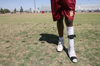 Darren Sanders, a Del Sol High football player, plays with the help of a prosthetic foot after the toes on his left foot were cut off three years ago in a freak accident.