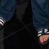 Photo: UFC fighter Chuck Liddell's post-UFC 100 pedicure. Photo: UFC fighter Chuck Liddell's post-UFC 100 pedicure.