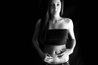 
Amanda Cicatello, then 15, was undergoing an appendectomy on March 15, 2008, when the surgeon punctured her aorta, causing her to bleed into her stomach cavity. Surgery to fix the aorta left a scar from her breastbone to below her navel. She remains self-conscious about her body and suffers bouts of depression. 