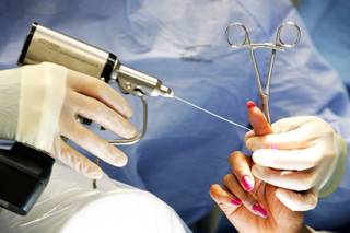 Dr. David Ring performs hand surgery at Mass General West in Waltham, Mass., Thursday, March 3, 2011.