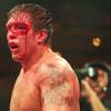 Photo: Derrick Mehmen bleeds heavily from a cut inflicted