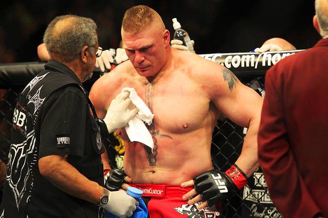 Brock Lesnar - UFC 141