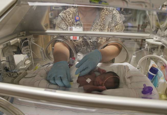 A neonatal intensive care unit nurse changes Deonee Derrico's diaper, Friday, Sept. 20, 2013, at Summerlin Hospital Medical Center in Las Vegas. Deonee was one in a set of quintuplets born to Deon and Evonne Derrico two weeks ago in Phoenix where the family moved 22 weeks into Evonne Derrico's pregnancy to be closer to doctors specializing in multiple births. They returned to Las Vegas with the quintuplets on three different medical flights on Friday.
