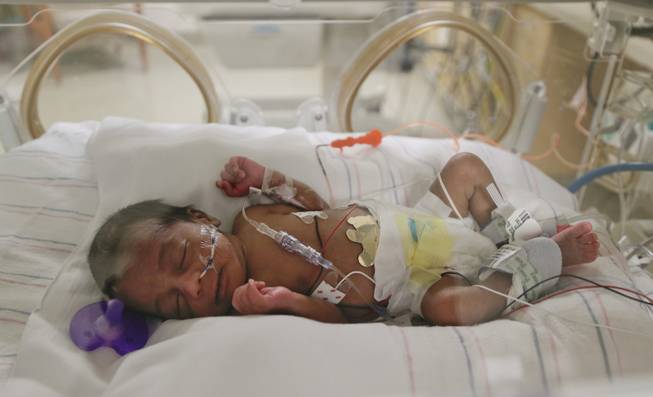 Dariz Derrico sleeps in an incubator at the neonatal intensive care unit at Summerlin Hospital Medical Center, Friday, Sept. 20, 2013, in Las Vegas. Dariz was one in a set of quintuplets born to Deon and Evonne Derrico two weeks ago in Phoenix where the family moved 22 weeks into Evonne Derrico's pregnancy to be closer to doctors specializing in multiple births. They returned to Las Vegas with the quintuplets on three different medical flights on Friday.