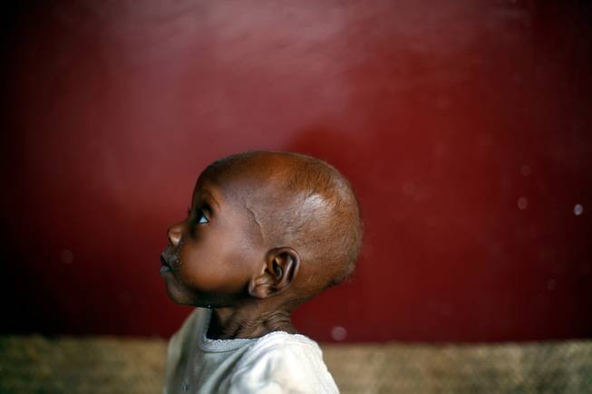 Waka, aged 2, a severely malnourished child sits on the floor at Bangui's pediatric center in Bangui, Central African Republic, Tuesday, Dec. 17, 2013. According to UNICEF's doctor Celestin Traore, even though malnutrition is high in the country, the problem is worsening due to the conflict. Traore expects to see over 150 malnourished children daily in the coming days as the humanitarian situation worsens. Over 1600 French troops have been deployed to the country in an effort to put an end to sectarian violence.