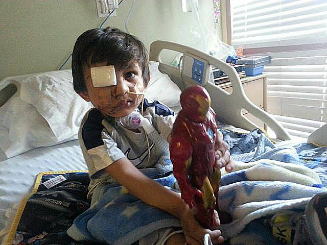 This February 2014 photo provided by Flor Medrano shows Kevin Vicente in Phoenix. Four-year-old Kevin Vicente’s road to recovery after a dog mauling on Feb. 20, 2014, which left him with a broken eye socket and jaw, and the boy has months, if not years, of reconstructive surgery ahead of him.