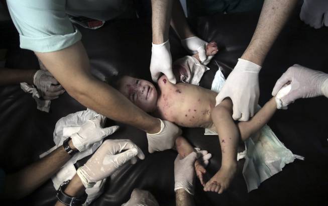 AP10ThingsToSee - Palestinian medics treat a wounded girl at the emergency room of the Shifa hospital in Gaza City, northern Gaza Strip, Friday, July 18, 2014. Thousands of Israeli soldiers launched a ground invasion in the Gaza Strip, escalating a 10-day campaign of heavy air bombardments to try to destroy Hamas' rocket-firing abilities and the tunnels militants use to infiltrate Israel.