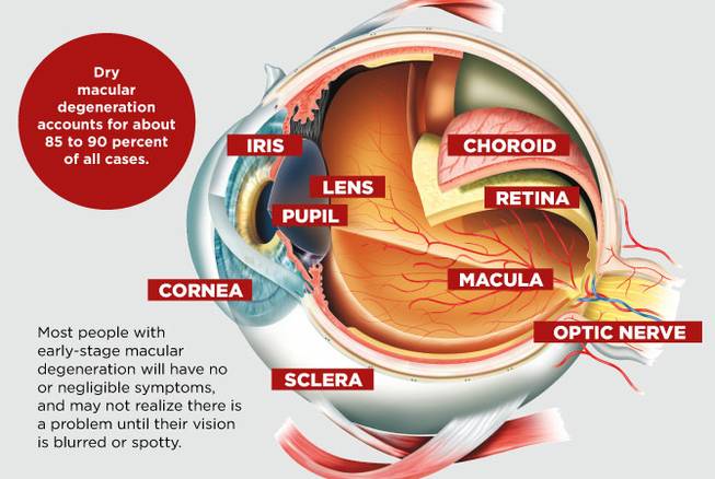 HCA macular degeneration native HCA macular degeneration native