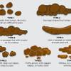 Photo: HCA what your poo says about you native Photo: HCA what your poo says about you native