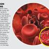 Photo: HCA blood clots and DVTs native Photo: HCA blood clots and DVTs native