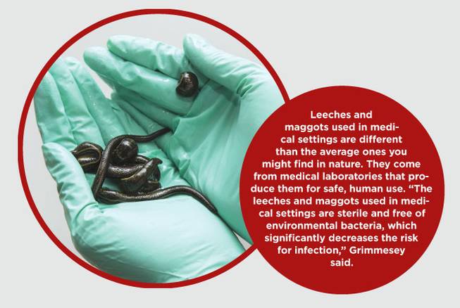 HCA leeches and maggots native HCA leeches and maggots native