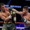 Photo: This Sept. 17, 2017, file photo shows Canelo Alvar Photo: This Sept. 17, 2017, file photo shows Canelo Alvar