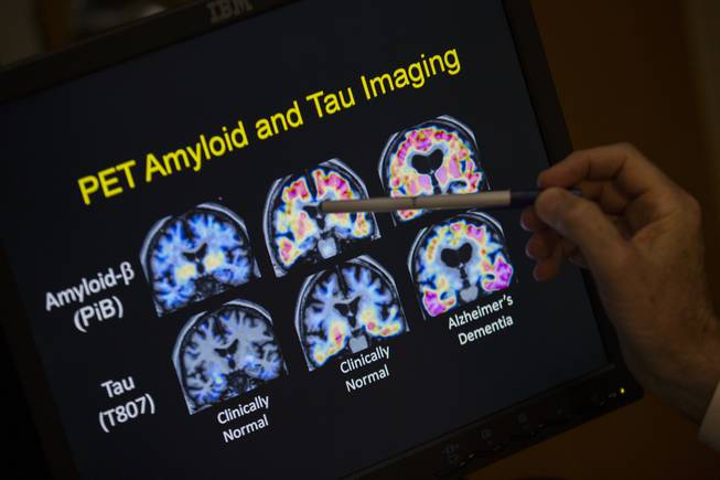 PET Scan PET Scan